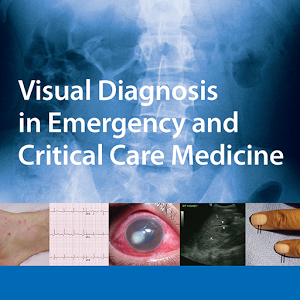 Visual Diag in E&Crit Ca M 2e v1.9.1