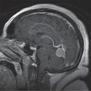 Neuroscience Lippincott's Q&A v1.0